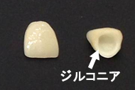 ジルコニアクラウン